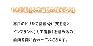 一次手術(インプラント)