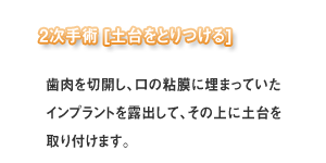 2次手術(インプラント)