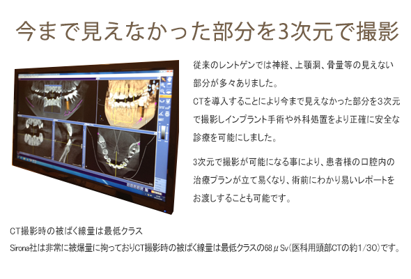 ORTHOPHOS XG 3D治療