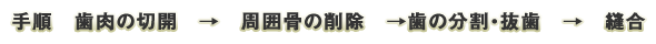 歯肉の切開　→　周囲骨の削除　→歯の分割・抜歯　→　縫合